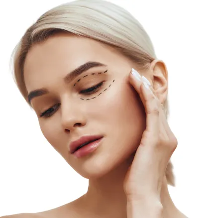 Blefaroplastyka powiek górnych i dolnych
