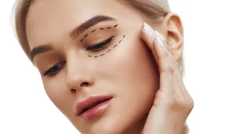 Blefaroplastyka powiek górnych i dolnych