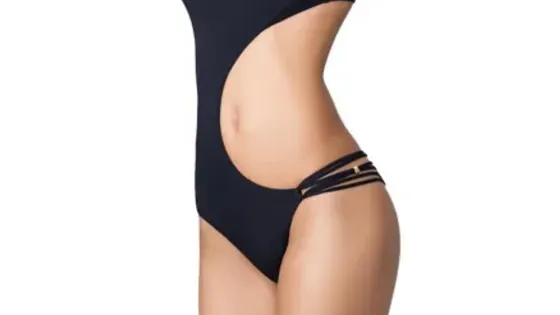 kriolipoliza