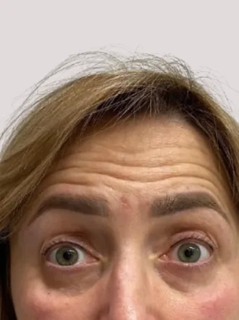przed