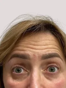 przed
